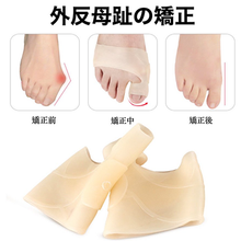 画像をギャラリービューアに読み込む, 外反母趾サポーター 外反母趾 両足セット 矯正グッズ 薄型 外反母趾矯正 シリコン 外反母趾対策 サポーター 治す 男女兼用